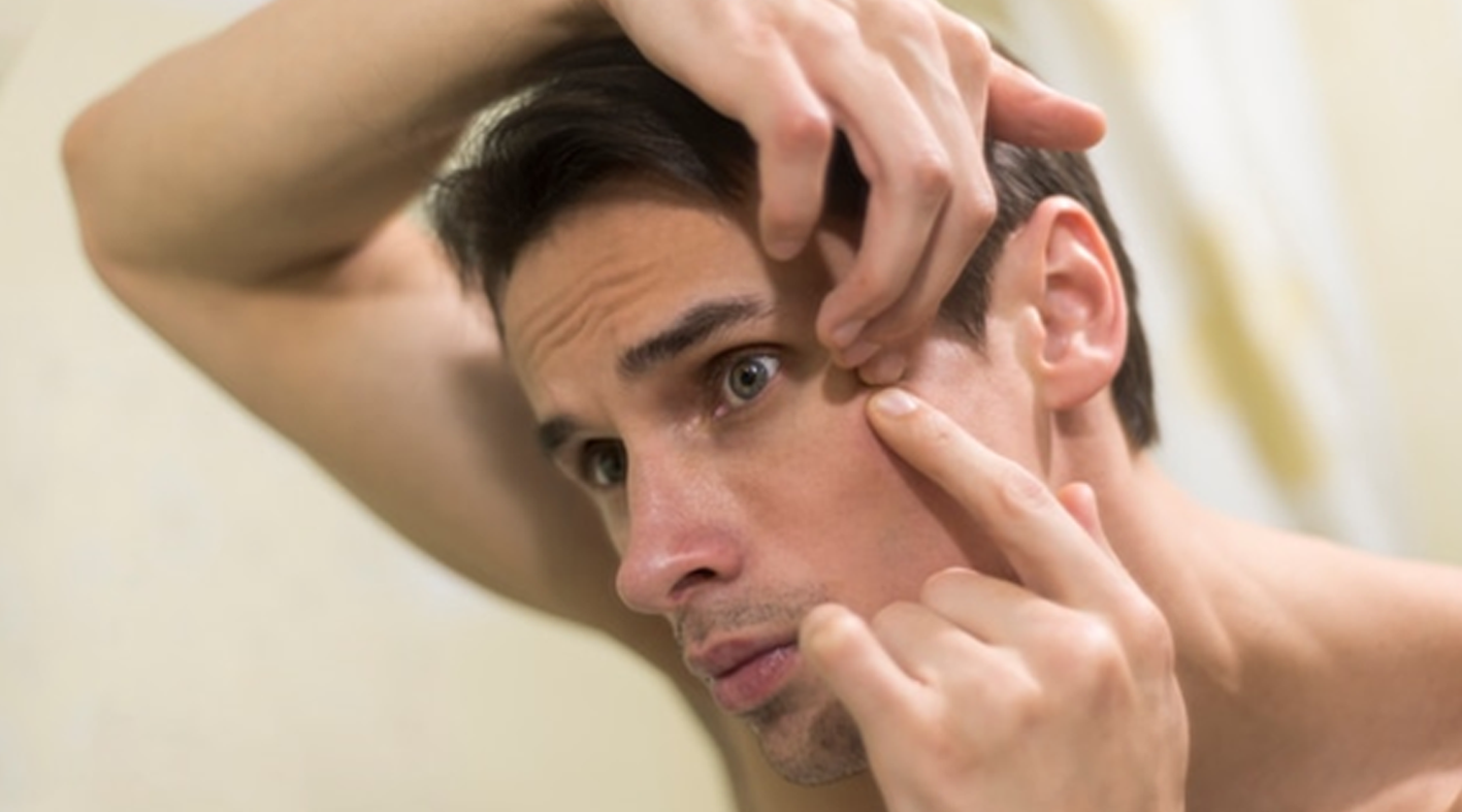 Say Goodbye to Acne and Wrinkles How Pycnogenol Can Revolutionize You