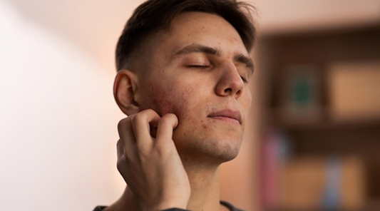 Men's Skincare: Bridging Gaps and Addressing Skin Concerns