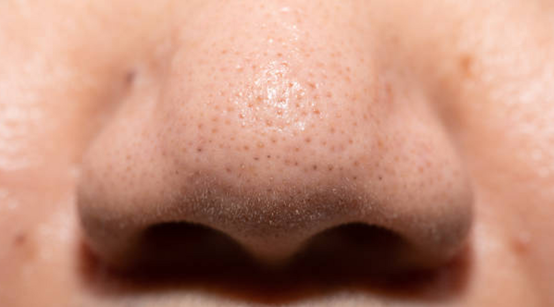 Clear Your Skin Naturally: How Squalene Oil Can Help Men's Clogged Pores