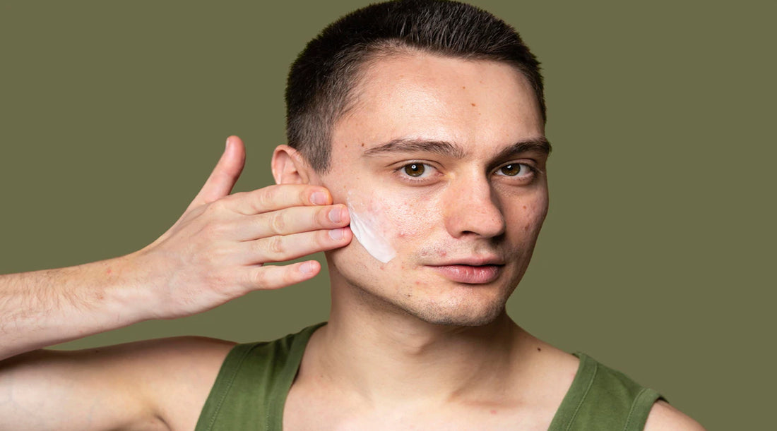 Image by <a href="https://www.freepik.com/free-photo/young-handsome-man-using-cream-acne_14603127.htm#query=men%20acne&position=6&from_view=search&track=sph">Freepik</a>