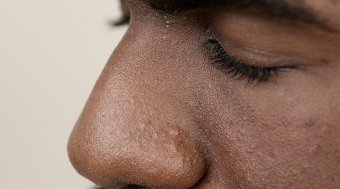 Discover the Benefits of Safflower Oil for Men's Oily Skin