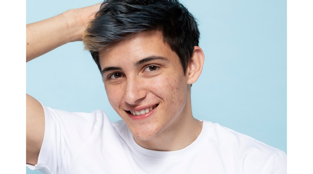 How to Fight Acne and Breakouts: Men's Skincare Solutions for Clear Skin with Retinol