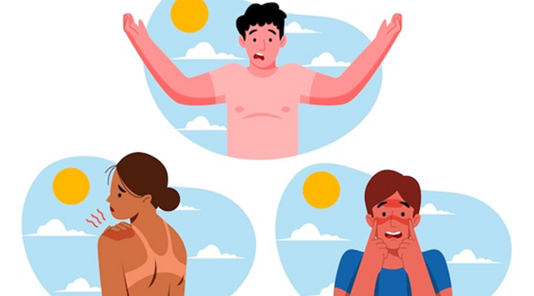 Men Skincare: How to Heal and Prevent Sunburn