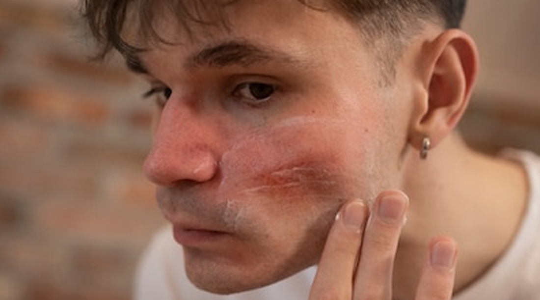 Men Skincare: Unveiling the Hidden Dangers of Harmful Ingredients