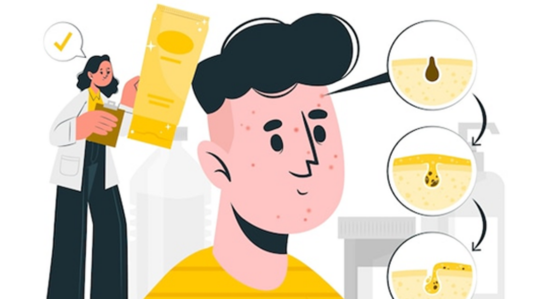 Men Skincare: Tackling Acne with Effective Solutions and Prevention