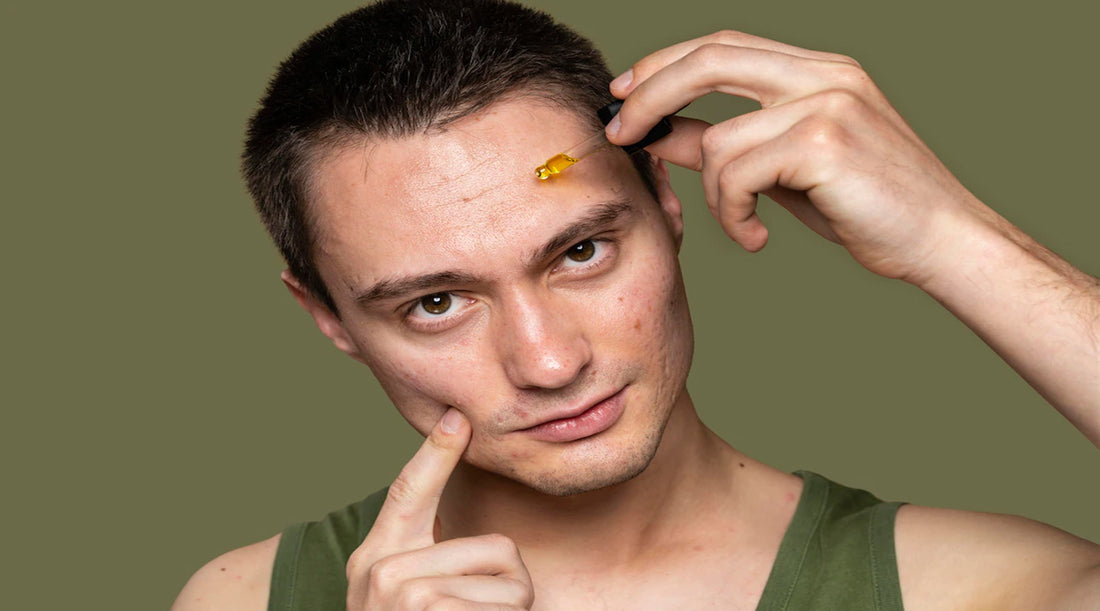 Image by <a href="https://www.freepik.com/free-photo/young-handsome-man-being-confident-with-his-acne_14603141.htm#query=men%20acne&position=7&from_view=search&track=sph">Freepik</a>