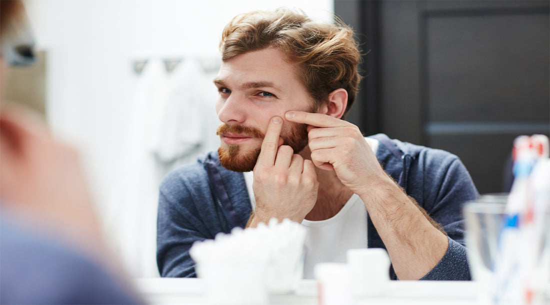 <a href="https://www.freepik.com/free-photo/man-with-pimple_5400129.htm#query=men%20skincare%20acne&position=1&from_view=search&track=sph">Image by pressfoto</a> on Freepik